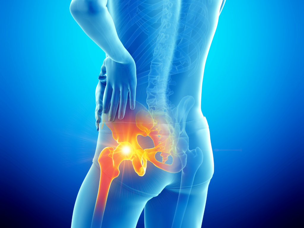 fisioterapia anca milano